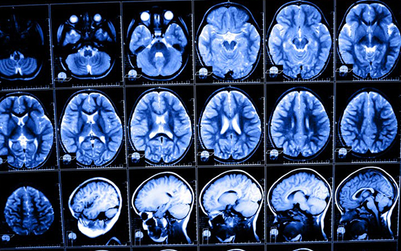 Images of various brain scans