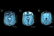 Cross section of human brain